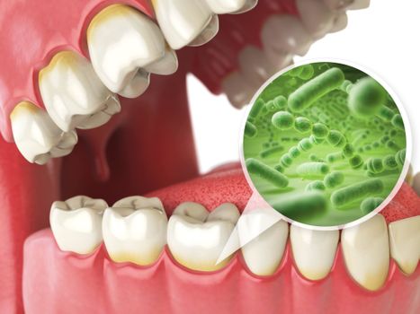 closeup image on teeth with germs