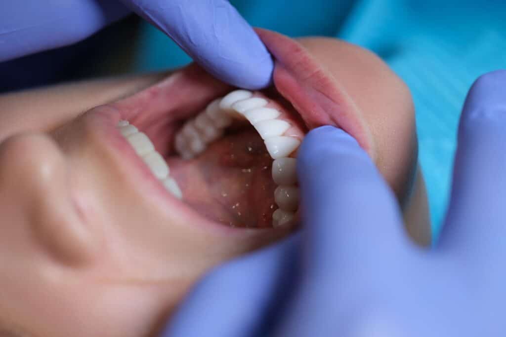 Oral Cancer Screenings Wall & Spring Lake NJ