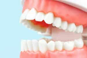 how stress affects your teeth